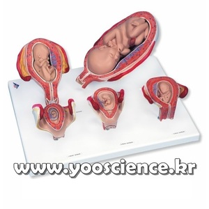 임신 시리즈, 5 가지 모형 Pregnancy Series - 5 Models L11/9 [1000331]